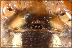 Epigyne